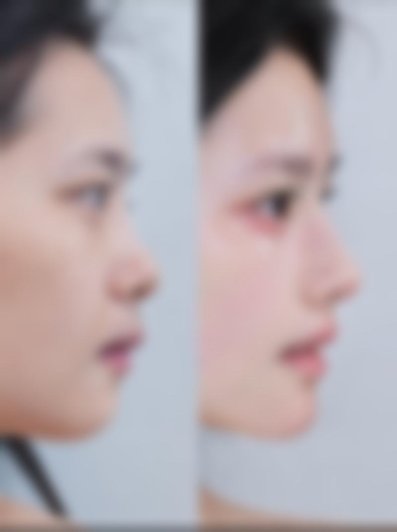 保定协和微整形美容医院医院技术好不好?