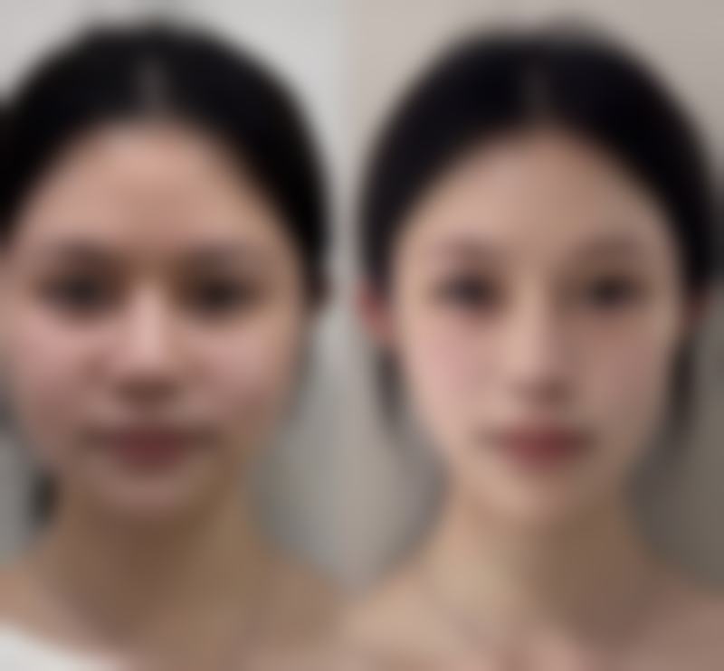 无锡东海整形美容门诊部收费标准参考