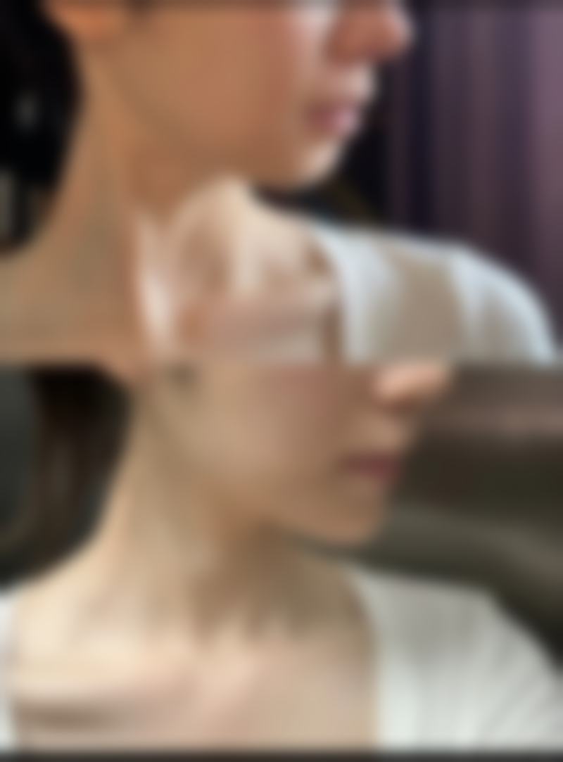 天津塘沽汉诚医学美容诊所收费标准参考