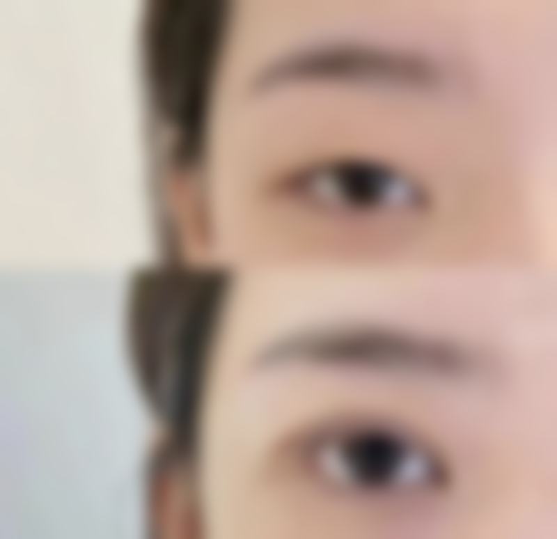 jj毛发移植口碑如何?
