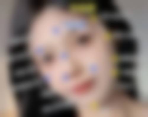 天津医 科 大学第二医院(整容与医疗美容科)口碑如何？