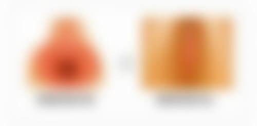 激光治疗去除多年烫伤疤痕