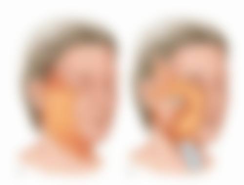 疤痕增生不医疗会带来心理影响