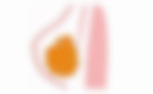 做完双眼皮可以吃什么菜？菠菜、胡萝卜、冬瓜等蔬菜或是不错选择