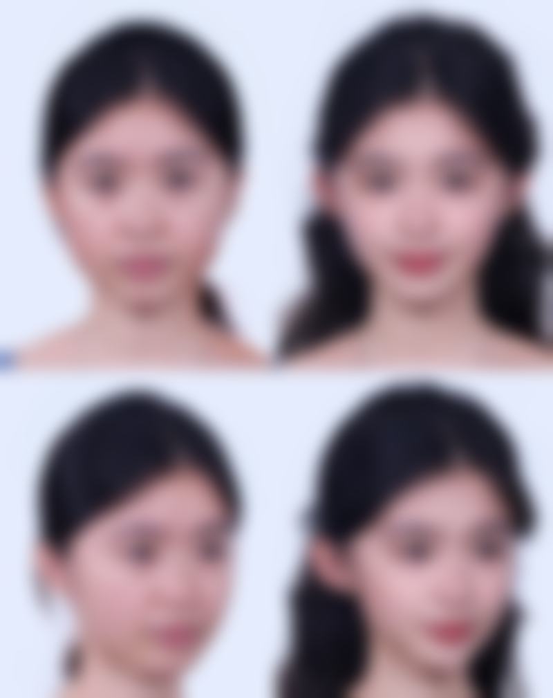 天津医 科 大学第二医院(整容与医疗美容科)医院技术好不好？