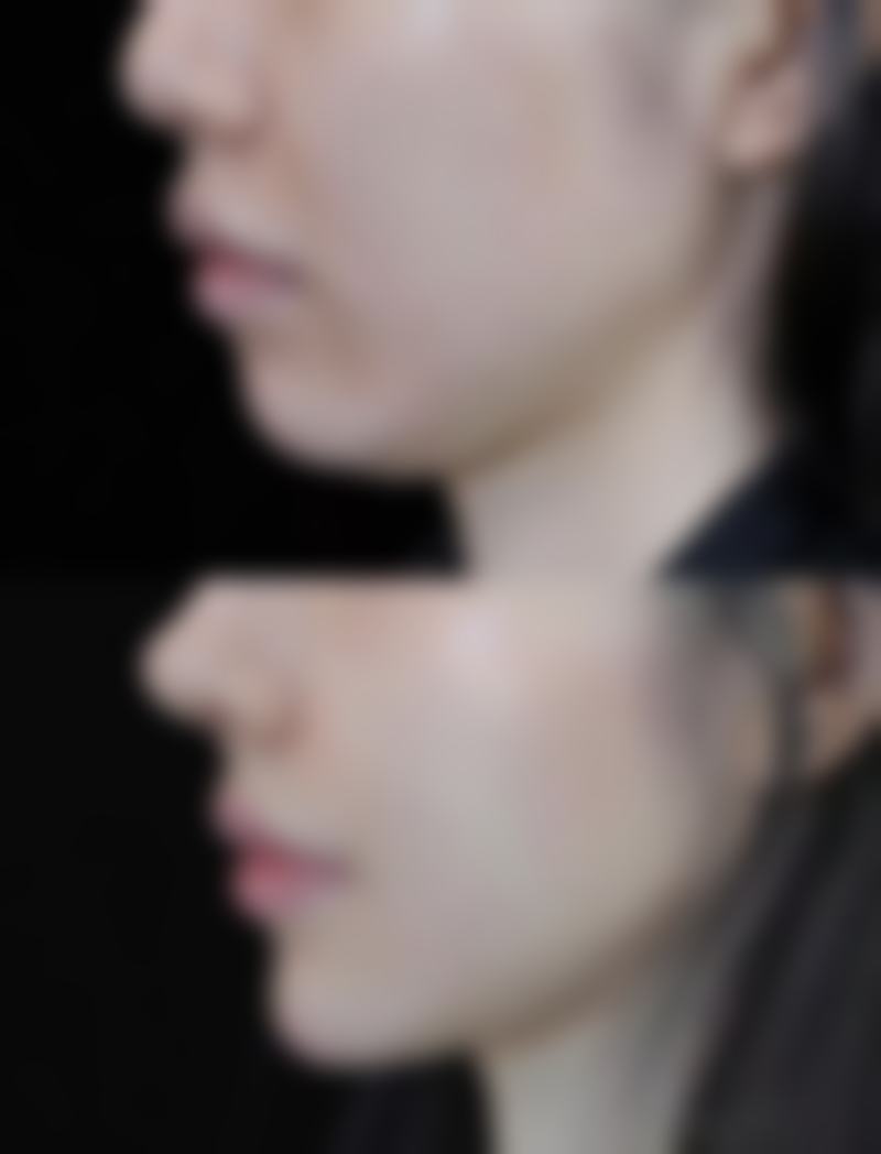 脾胃与眼袋的关系