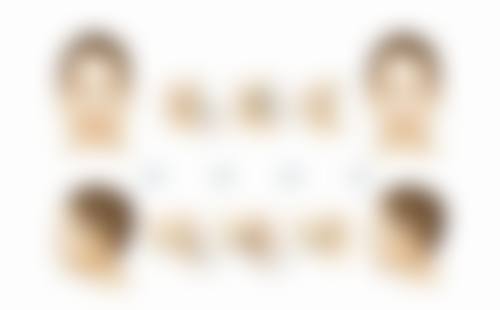 隆鼻多久过增生期？一般3 - 6个月，哪些因素会影响时长和增生表现呢