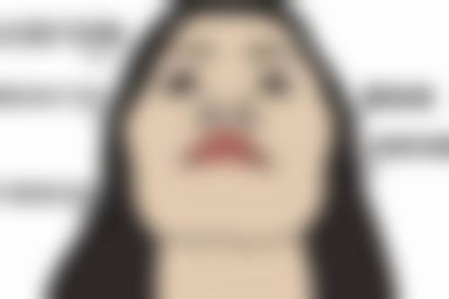 割双眼皮手术大概多久？受手术方式、眼部条件等影响，恢复又需多久呢