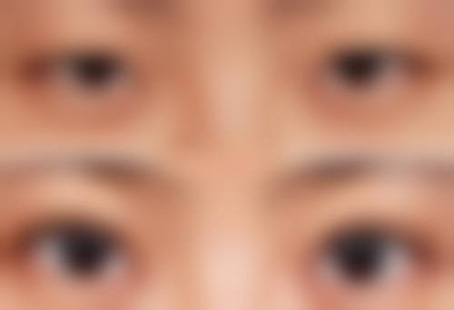 贵阳观山湖美和谐医疗美容收费标准参考