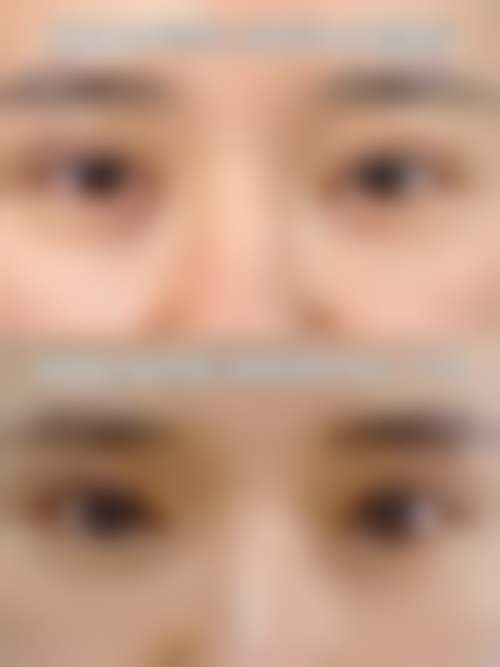 北京美雅枫医疗美容医院李晓曦医生技术好不好？