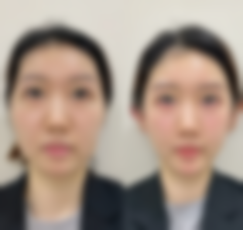 北京苏亚整形医疗美容医院医院技术好不好？
