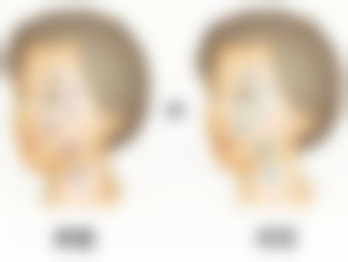 南宁美初医疗美容门诊部李世碧医生挂号预约攻略