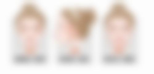 总结——徐州薇莱美医疗美容诊所陈志朝医生怎么样？