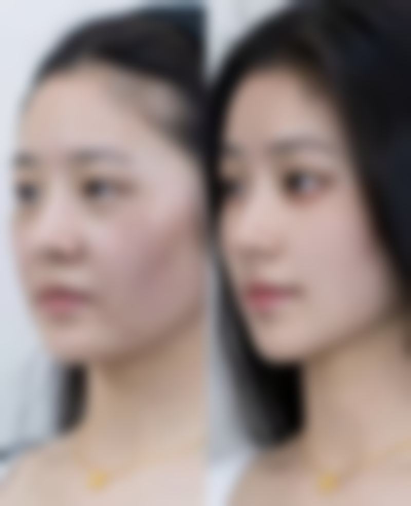 武汉研美荟医疗美容门诊部（原美邺）医院技术好不好？