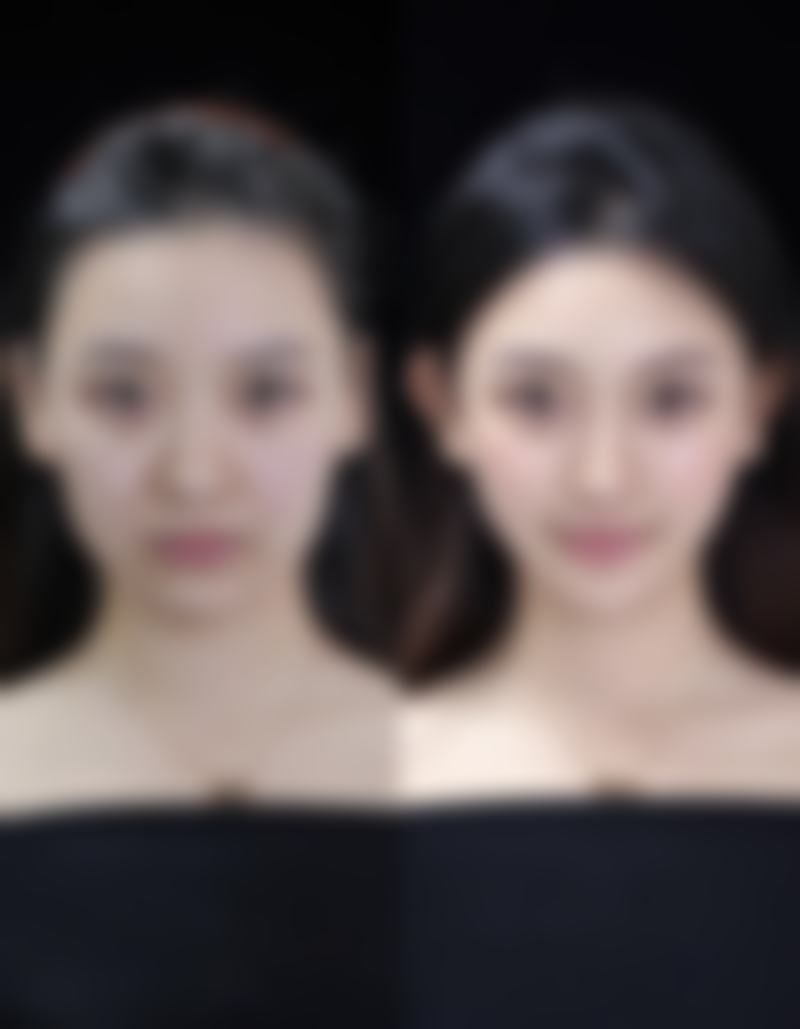 西安美立方医疗美容医院医院技术好不好?