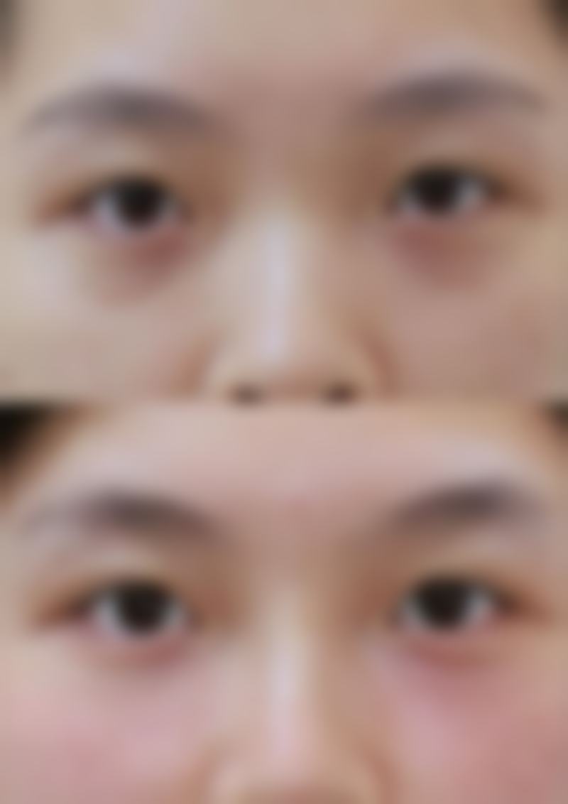 总结——长沙花样年华美容医院邓晓林医生怎么样?