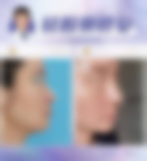 广州高尚医学美容中 心龚忠华医生技术好不好?