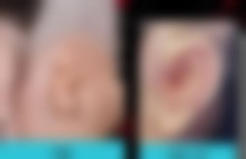 西安爱特蜜医疗美容诊所医院技术好不好？