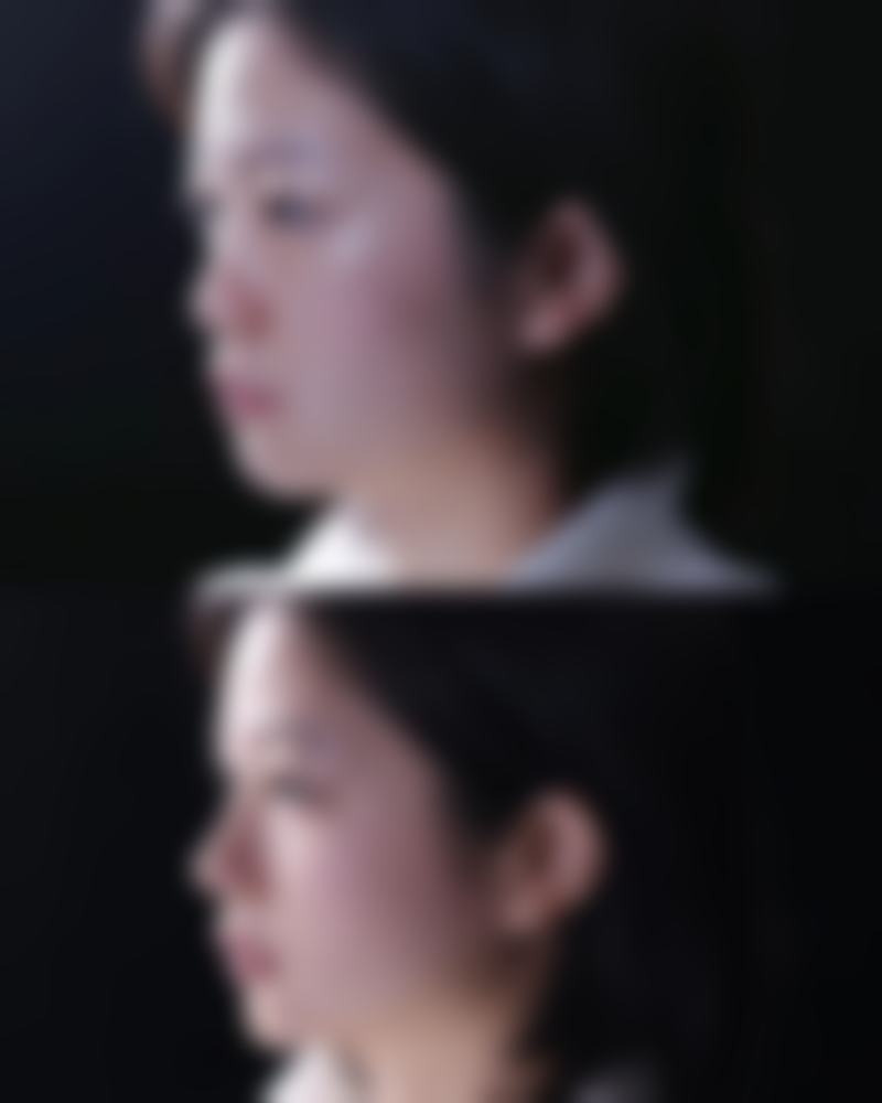 南通美诺医疗美容杨翔航医生技术好不好?
