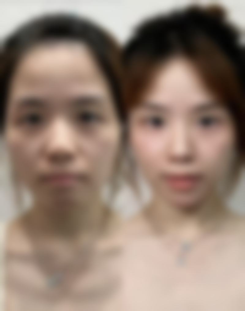 抚州德尔美客肖洋医生口碑评价如何？