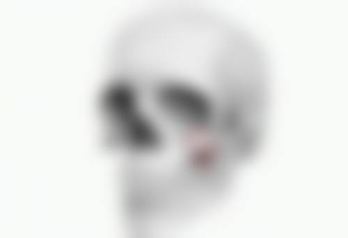 总结:艾灸眼部可以去除眼袋吗