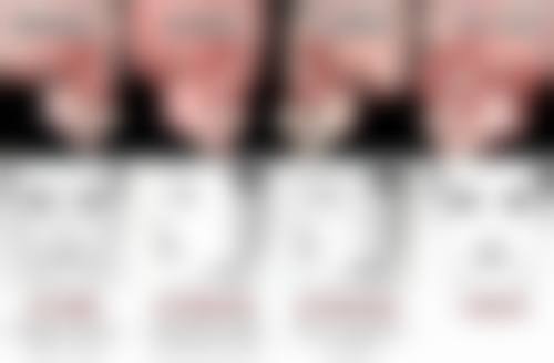 武汉斯启诺医疗美容门诊部王伟民医生有哪些真实实例？