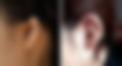 锦州海峰整形美容诊所口碑如何?