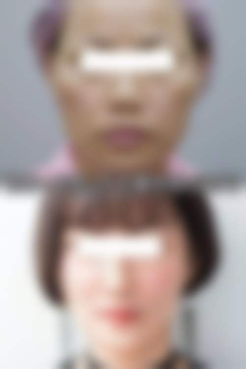 新疆四七四 医院整形科收费标准参考