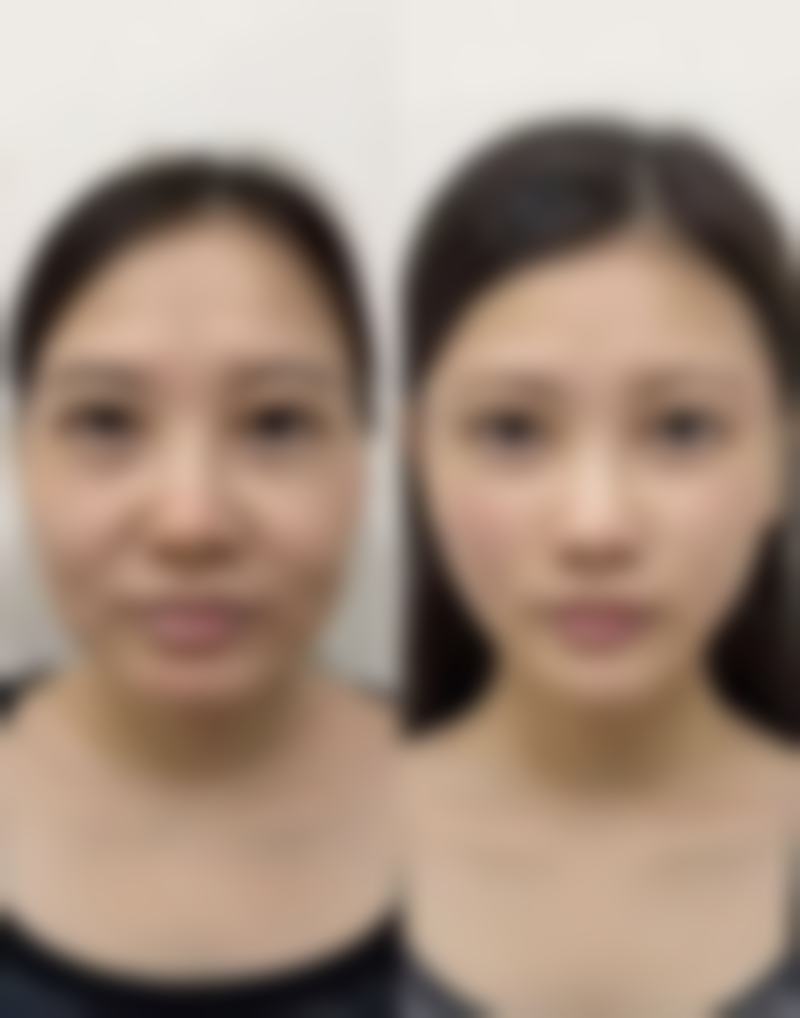 韩国Liting整形外科金熙京医生挂号预约攻略