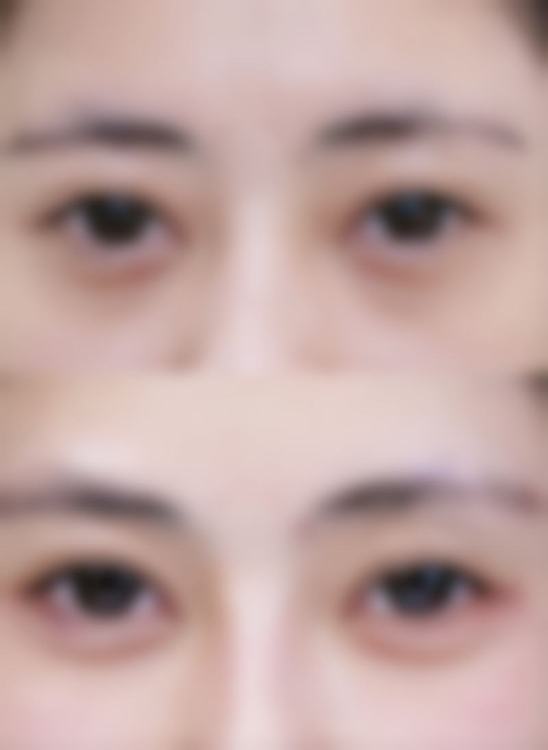 总结——韩国Liting整形外科安德基医生怎么样?