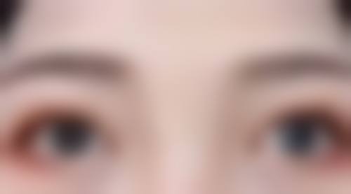 打瘦脸针后的注意事项