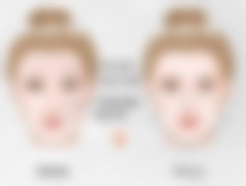 总结——昆明博美医学整形美容医院怎么样?