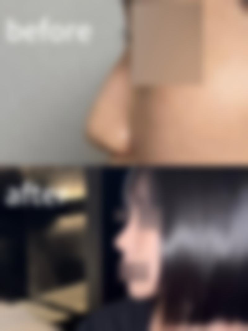 赣州虔美小森林医疗美容门诊部医院技术好不好?