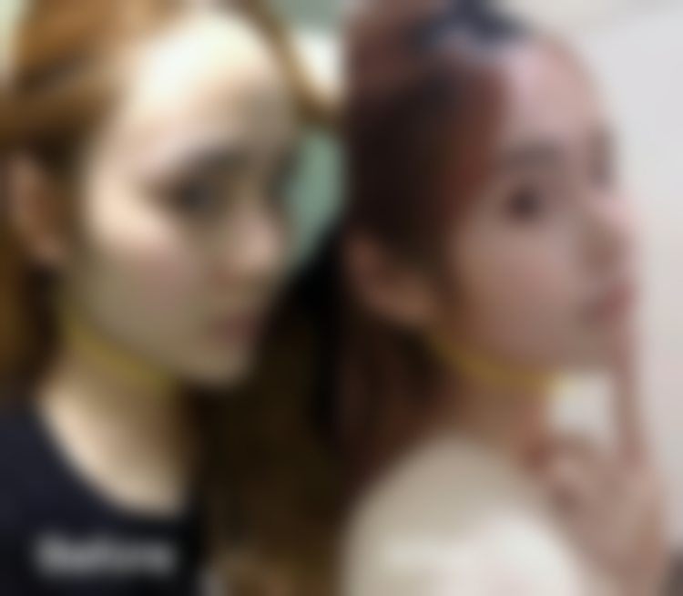 杭州连天美医疗美容医院梁帮荣的患者口碑怎样?