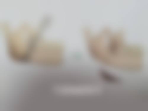 下颚骨整形修复的大致阶段