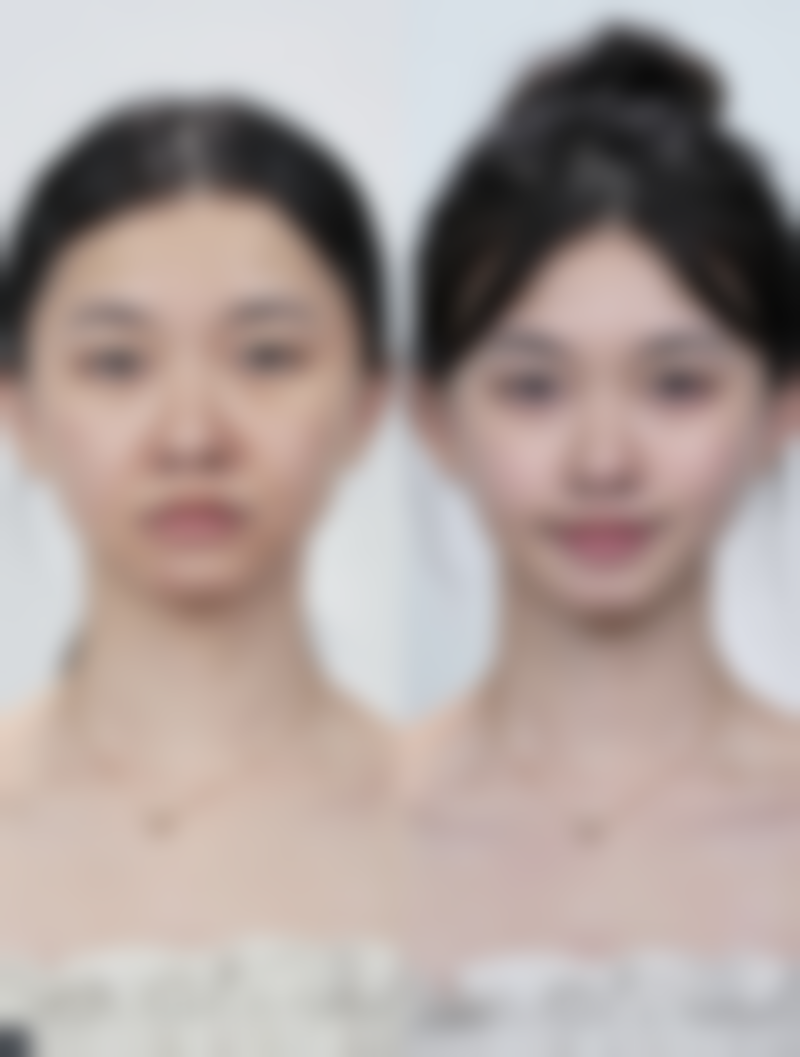 总结——佛山贝尔美医疗美容专科医院怎么样?