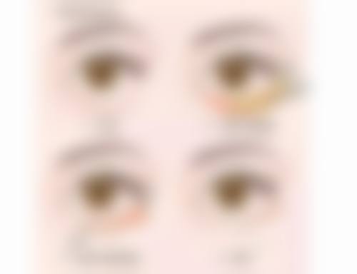 影响脸打美白针间隔时间的因素