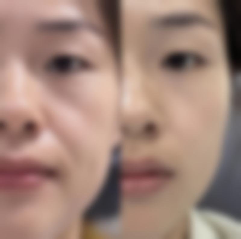 成都高富雷医生技术好不好?