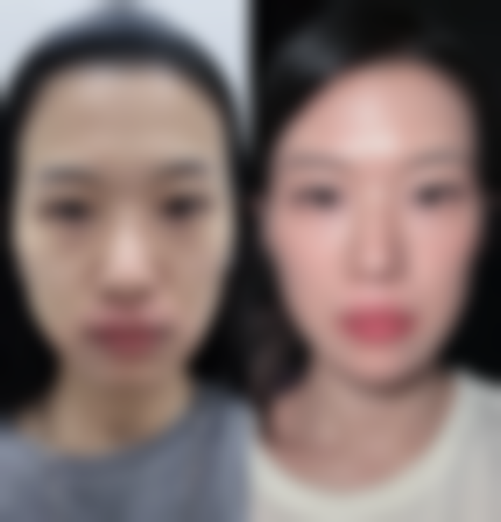 衡阳华美医疗美容门诊部收费标准参考