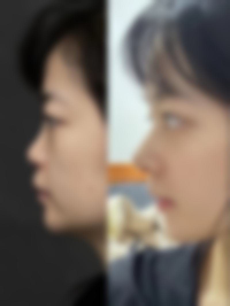 济南蔡景龙医疗美容门诊部郝建国医生技术好不好?
