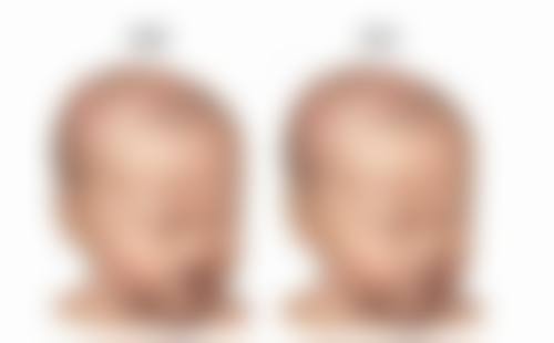 东莞可玫尔医疗美容谢政华医生技术好不好?