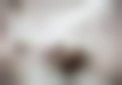 苏州美贝尔美容医院海魅玻尿酸除皱套餐的口碑好不好?