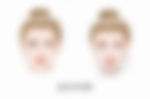 打了瘦脸针没成效,是不是产品质量不过关?