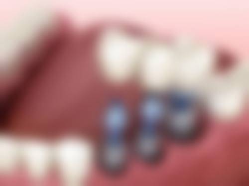 郑胜医生擅长的口腔项目