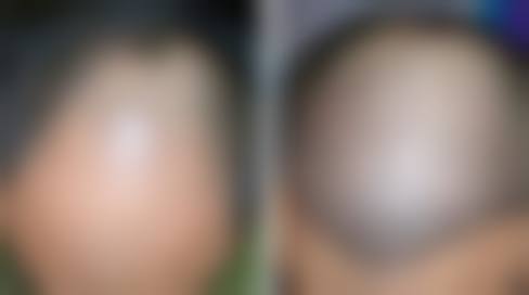 高端设备与环境——层流手术室,正版材料认证