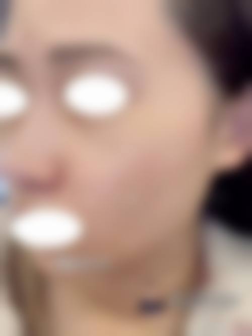成都泊菲凯莉整形医学美容治疗反馈与口碑评价。