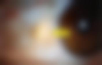 临沂莒南光明眼科医院治疗反馈与口碑评价。