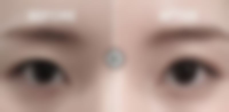 总结——重庆禾熹医疗美容门诊部怎么样?