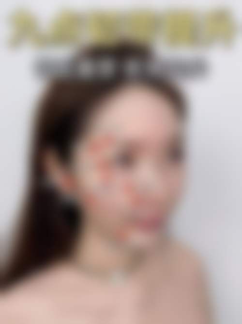 河南大学附属南石医院烧伤整形美容中 心口碑评价