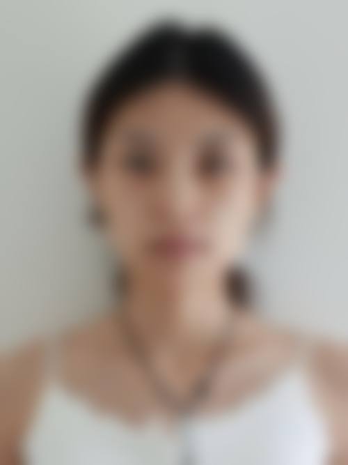 河南大学附属南石医院烧伤整形美容中 心预约方式